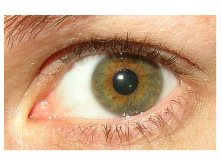Acid in the eye procedure