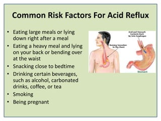 Common Risk Factors For Acid Reflux
• Eating large meals or lying
down right after a meal
• Eating a heavy meal and lying
on your back or bending over
at the waist
• Snacking close to bedtime
• Drinking certain beverages,
such as alcohol, carbonated
drinks, coffee, or tea
• Smoking
• Being pregnant
 