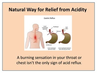 Natural Way for Relief from Acidity
A burning sensation in your throat or
chest isn't the only sign of acid reflux.
 