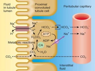 Acidosis metabólica
Implica una deficiencia primaria de la base
HCO3- y una disminución del pH plasmático
 
