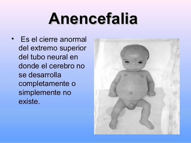 ¿Quién puede tener un bebé con un¿Quién puede tener un bebé con un
Defecto del Tubo Neural (DTN)?Defecto del Tubo Neural (...