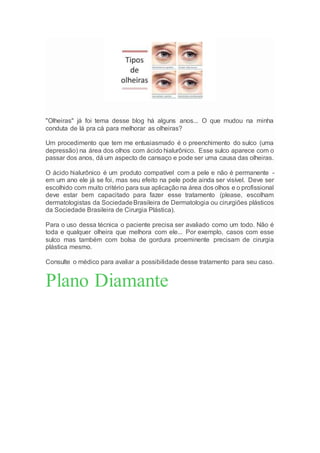 "Olheiras" já foi tema desse blog há alguns anos... O que mudou na minha
conduta de lá pra cá para melhorar as olheiras?
Um procedimento que tem me entusiasmado é o preenchimento do sulco (uma
depressão) na área dos olhos com ácido hialurônico. Esse sulco aparece com o
passar dos anos, dá um aspecto de cansaço e pode ser uma causa das olheiras.
O ácido hialurônico é um produto compatível com a pele e não é permanente -
em um ano ele já se foi, mas seu efeito na pele pode ainda ser visível. Deve ser
escolhido com muito critério para sua aplicação na área dos olhos e o profissional
deve estar bem capacitado para fazer esse tratamento (please, escolham
dermatologistas da SociedadeBrasileira de Dermatologia ou cirurgiões plásticos
da Sociedade Brasileira de Cirurgia Plástica).
Para o uso dessa técnica o paciente precisa ser avaliado como um todo. Não é
toda e qualquer olheira que melhora com ele... Por exemplo, casos com esse
sulco mas também com bolsa de gordura proeminente precisam de cirurgia
plástica mesmo.
Consulte o médico para avaliar a possibilidade desse tratamento para seu caso.
Plano Diamante
 