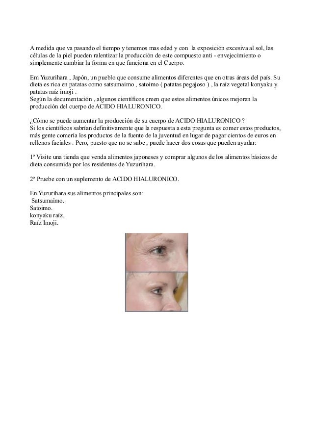 alimentos que contienen acido hialuronico acido hialuronico alimentos alimentos que contienen acido hialuronico acido hialuronico alimentos