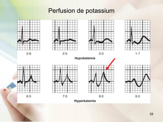 28
Perfusion de potassium
 