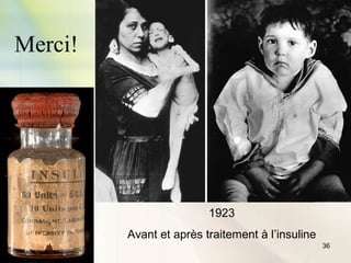 36
Merci!
1923
Avant et après traitement à l’insuline
 