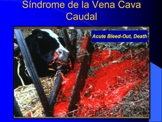 Síndrome de la Vena Cava
Caudal
 