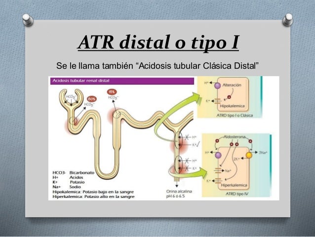 Acidosis tubular renal