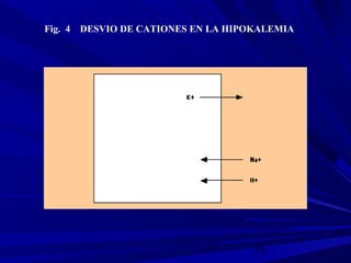 73
Fig. 4 DESVIO DE CATIONES EN LA HIPOKALEMIA
 