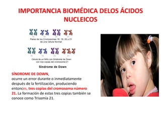 IMPORTANCIA BIOMÉDICA DELOS ÁCIDOS
NUCLEICOS
SÍNDROME DE DOWN,
ocurre un error durante o inmediatamente
después de la fertilización, produciendo
entonces, tres copias del cromosoma número
21. La formación de estas tres copias también se
conoce como Trisomía 21.
 