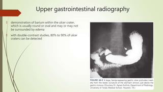 Upper gastrointestinal radiography
🠶 demonstration of barium within the ulcer crater,
which is usually round or oval and may or may not
be surrounded by edema
🠶 with double-contrast studies, 80% to 90% of ulcer
craters can be detected
 
