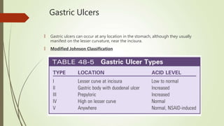 Gastric Ulcers
🠶 Gastric ulcers can occur at any location in the stomach, although they usually
manifest on the lesser curvature, near the incisura.
🠶 Modified Johnson Classification
 