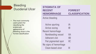 Bleeding
Duodenal Ulcer
• The most commonly
used system for
classifying the
endoscopic
appearance of
bleeding ulcers is the
Forrest classification
 