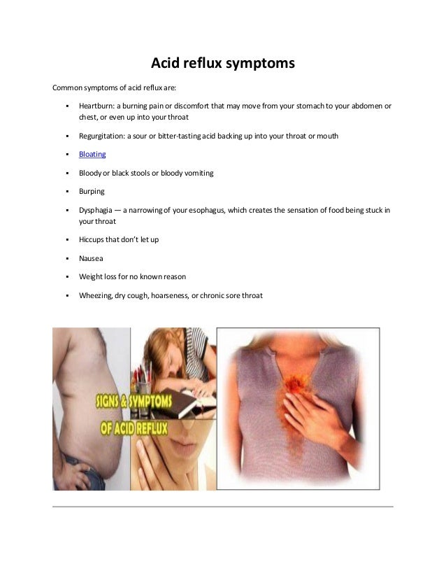 Acid reflux Acid reflux