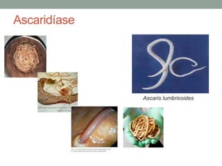 Ascaridíase




              Ascaris lumbricoides
 