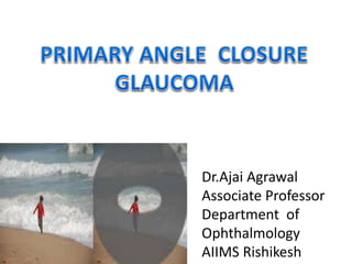 Dr.Ajai Agrawal
Associate Professor
Department of
Ophthalmology
AIIMS Rishikesh
 