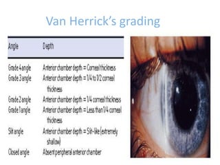 Van Herrick’s grading
 