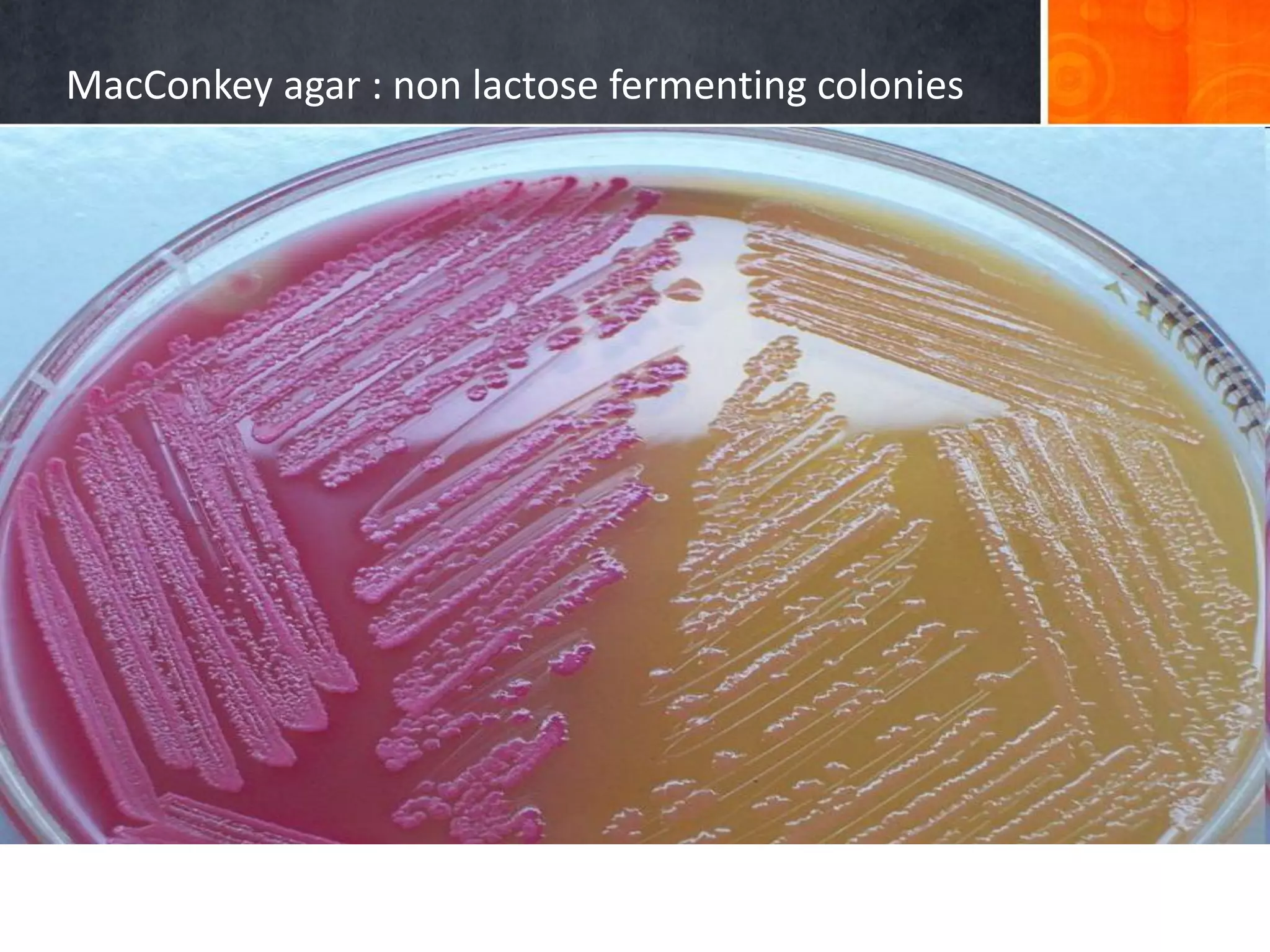MacConkey agar : non lactose fermenting colonies

 