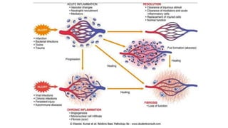ACUTE INFLAMMATION- CHEMICAL MEDIATORS AND ROLE OF LYMPHATICS AN OVER ...