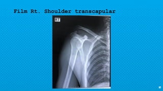 10
Film Rt. Shoulder transcapular
 