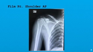11
Film Rt. Shoulder AP
 