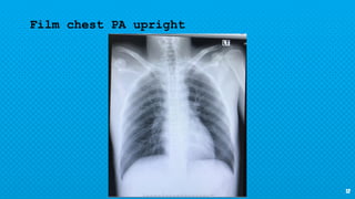 12
Film chest PA upright
 