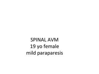 SPINAL AVM
 19 yo female
mild paraparesis
 