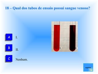 18 – Qual dos tubos de ensaio possui sangue venoso? I. II. Nenhum. seguinte A C B I II 