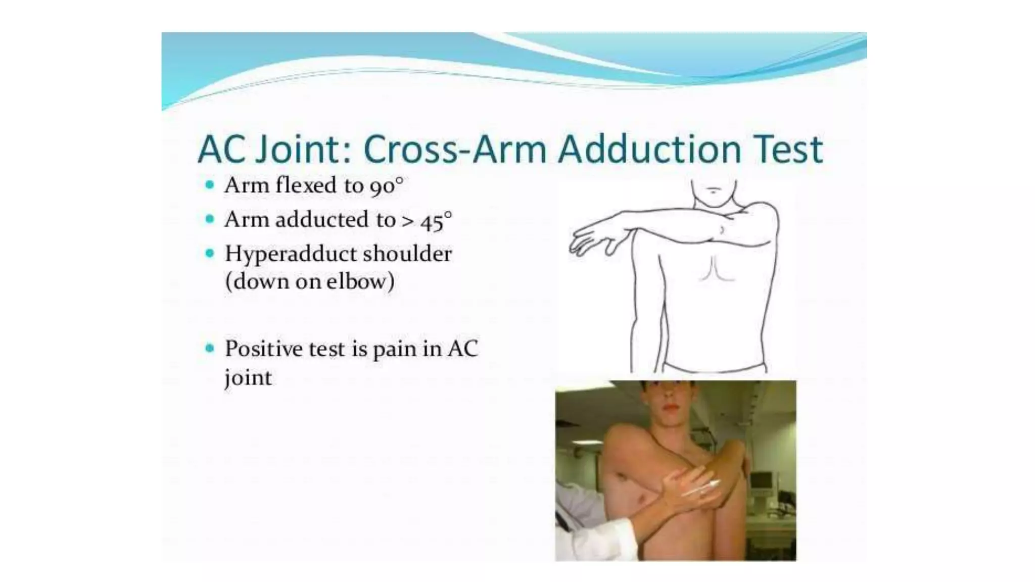 acromioclavicular joint dislocation.pptx