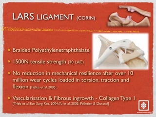 LARS LIGAMENT (CORIN)
Braided Polyethylenetraphthalate
1500N tensile strength (30 LAC)
No reduction in mechanical resilience after over 10
million wear cycles loaded in torsion, traction and
fl
exion [Fialka et al. 2005;
Vascularisation & Fibrous ingrowth - Collagen Type 1
[Trieb et al. Eur Surg Res. 2004;Yu et al. 2005; Pelletier & Durand]
 