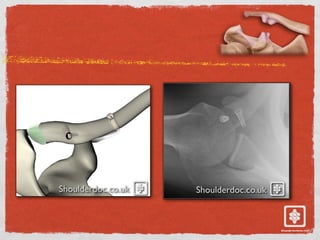 Shoulderdoc.co.uk Shoulderdoc.co.uk
 