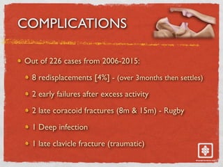 COMPLICATIONS
Out of 226 cases from 2006-2015:
8 redisplacements [4%] - (over 3months then settles)
2 early failures after excess activity
2 late coracoid fractures (8m & 15m) - Rugby
1 Deep infection
1 late clavicle fracture (traumatic)
 