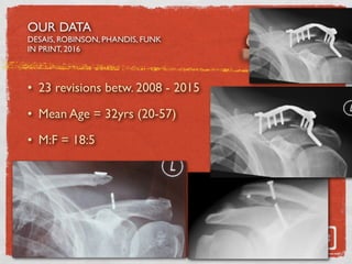 OUR DATA
DESAIS, ROBINSON, PHANDIS, FUNK
IN PRINT, 2016
• 23 revisions betw. 2008 - 2015
• Mean Age = 32yrs (20-57)
• M:F = 18:5
 