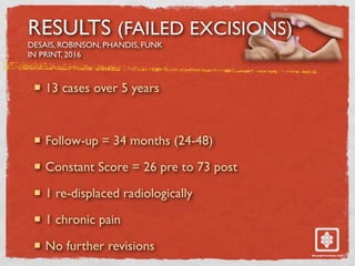 RESULTS (FAILED EXCISIONS)
DESAIS, ROBINSON, PHANDIS, FUNK
IN PRINT, 2016
! 13 cases over 5 years
! Follow-up = 34 months (24-48)
! Constant Score = 26 pre to 73 post
! 1 re-displaced radiologically
! 1 chronic pain
! No further revisions
 