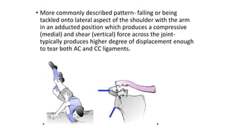 ACROMIOCLAVICULAR JOINT INJURY | PPTX