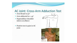 ACROMIOCLAVICULAR JOINT INJURY | PPTX