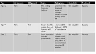 ACROMIOCLAVICULAR JOINT INJURY | PPTX