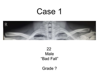 Case 1
22
Male
“Bad Fall”
Grade ?
 