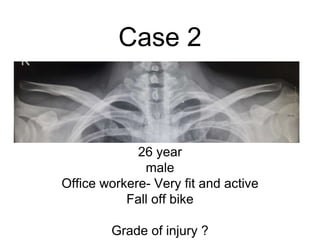 Case 2
26 year
male
Office workere- Very fit and active
Fall off bike
Grade of injury ?
 