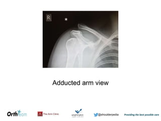 @shoulderpedia
Adducted arm view
 