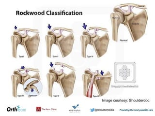 @shoulderpedia
Image courtesy: Shoulderdoc
 