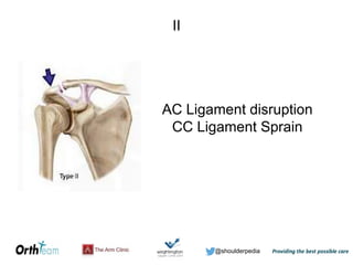 @shoulderpedia
AC Ligament disruption
CC Ligament Sprain
II
 
