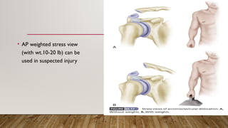 • AP weighted stress view
(with wt.10-20 lb) can be
used in suspected injury
 