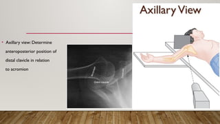 • Axillary view: Determine
anteroposterior position of
distal clavicle in relation
to acromion
 