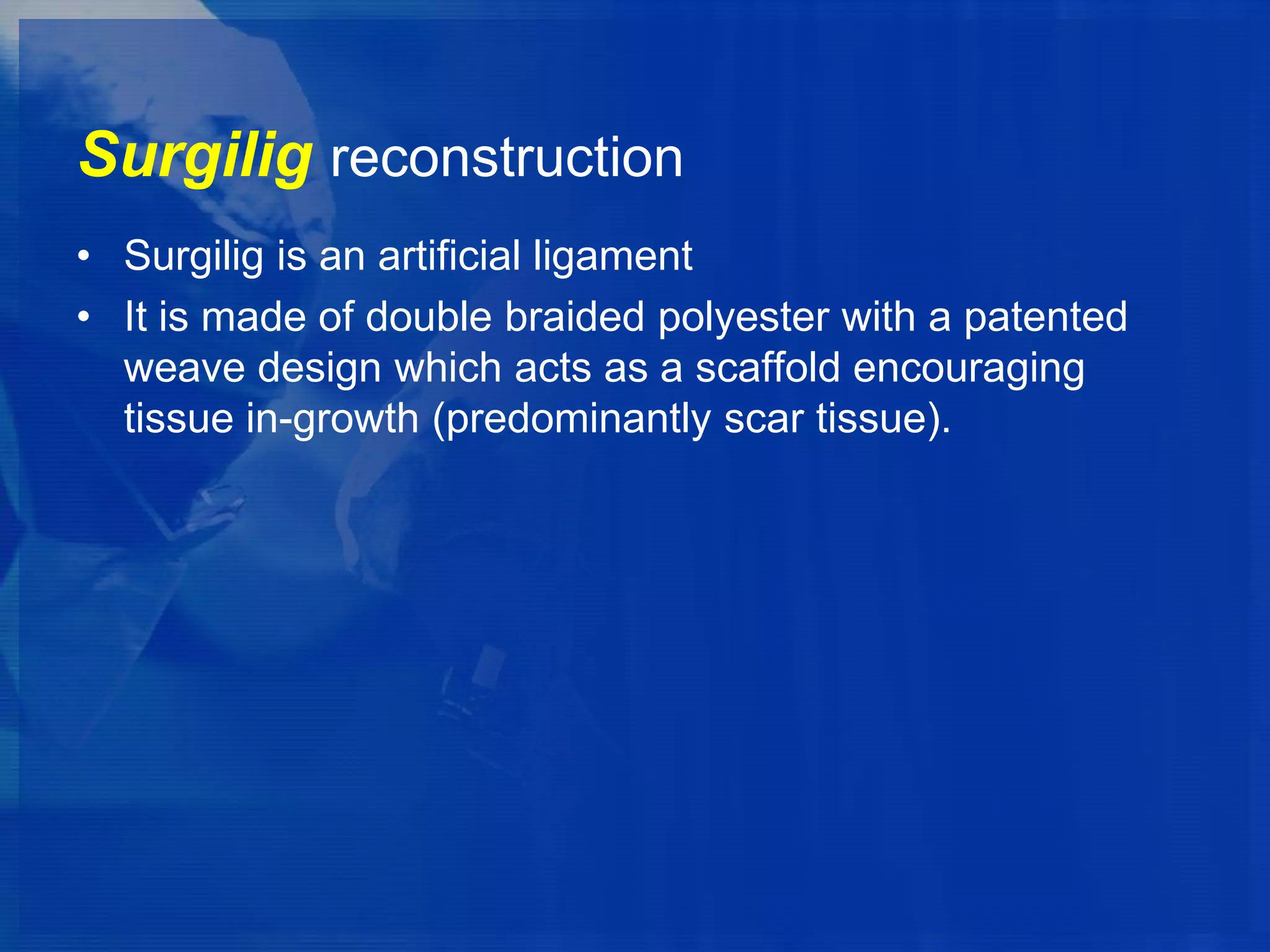 Surgilig reconstruction
• Surgilig is an artificial ligament
• It is made of double braided polyester with a patented
weave design which acts as a scaffold encouraging
tissue in-growth (predominantly scar tissue).

 