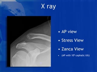 zanca-view-x-ray