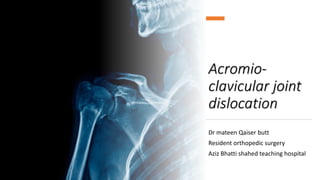 Acromio-
clavicular joint
dislocation
Dr mateen Qaiser butt
Resident orthopedic surgery
Aziz Bhatti shahed teaching hospital
 