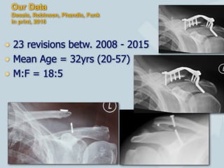 Our Data
Desais, Robinson, Phandis, Funk
In print, 2016
• 23 revisions betw. 2008 - 2015
• Mean Age = 32yrs (20-57)
• M:F = 18:5
13
 