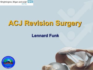 ACJ Revision Surgery
Lennard Funk
 