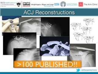 @thearmclinic
ACJ Reconstructions
>100 PUBLISHED!!
 