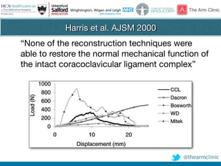 @thearmclinic
Harris et al. AJSM 2000
“None of the reconstruction techniques were
able to restore the normal mechanical function of
the intact coracoclavicular ligament complex”
 